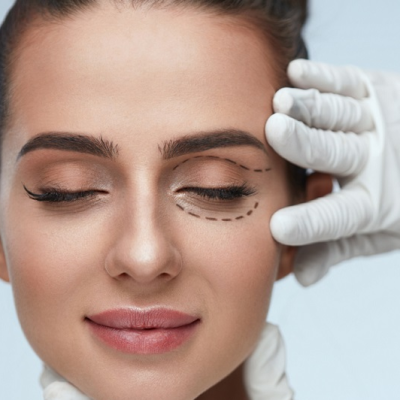 blefaroplastia-clinica-inpelle