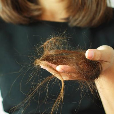 queda-de-cabelo-inpelle-capa